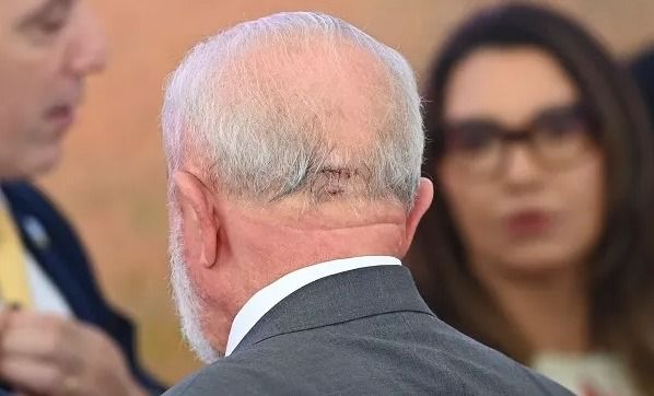 lula-pontos-zoom_ba53a4.jpg