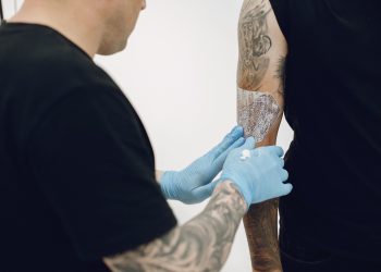 Fiz uma tatuagem durante o verão: como cuidar?