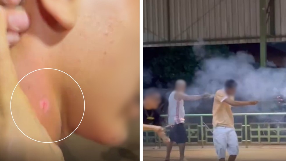 adolescente-e-atingido-por-fogo-em-evento-de-guerra-de-foguetes-em-goiania.-organizador-defende-acao-recreativa-e-beneficente