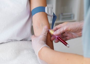 entenda o passo a passo de como fazer em 2025