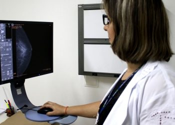 Entidades médicas pedem faixa etária maior para mamografia de rastreio