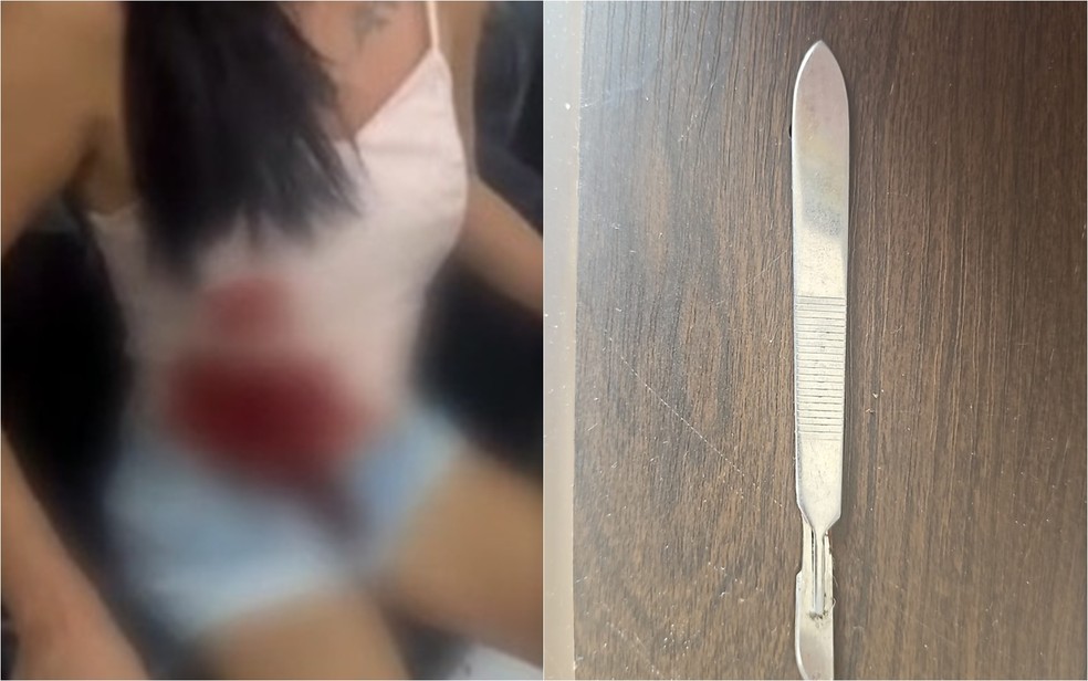 manicure-em-rio-verde-e-suspeita-de-ferir-cliente-com-bisturi-durante-briga-policia-investiga-caso-e-ouve-versoes-de-ambas-as-partes