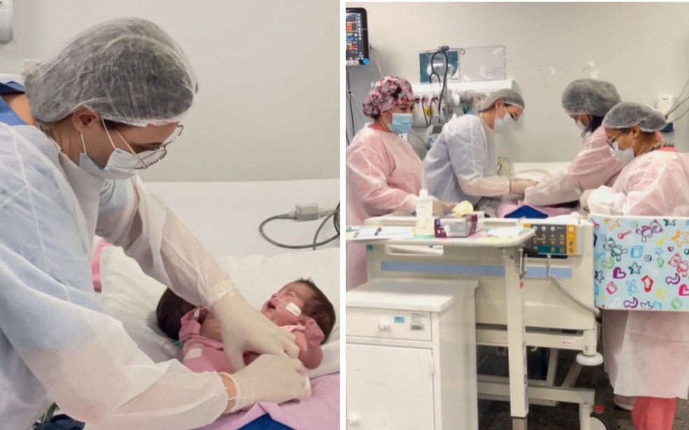 gemeas-siamesas-viajam-para-cirurgia-de-separacao-em-goiania3A-expectativa-de-sucesso