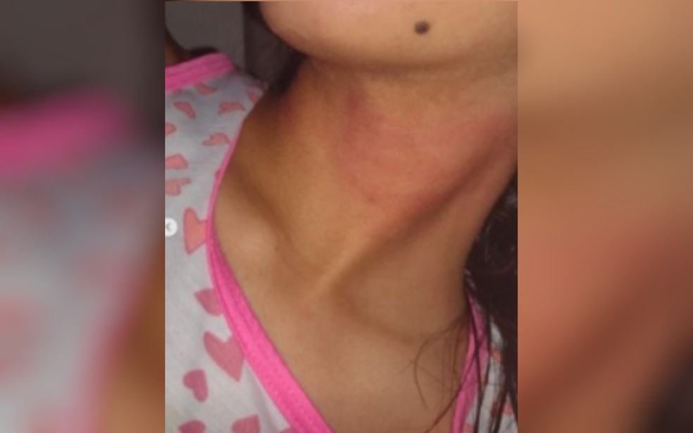 pai-e-preso-por-agredir-filha-de-17-anos-em-aparecida-de-goiania3A-caso-e-investigado-pela-dpca