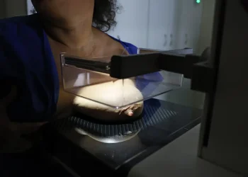 Vigitel: 92% das brasileiras entre 50 e 69 anos fizeram mamografia